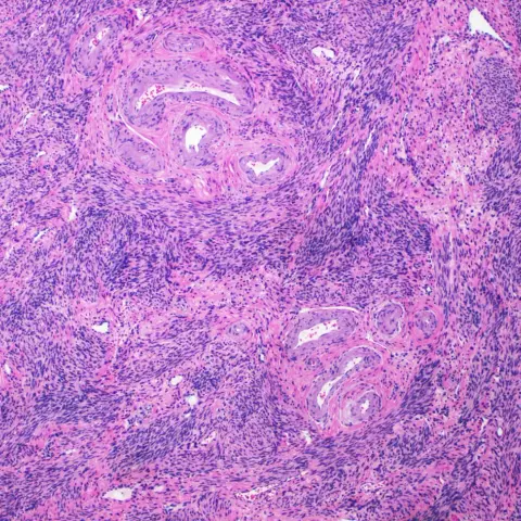 Low-power micrograph of uterine muscle with pink bundles of smooth muscle running in different directions and small blood vessels among them.