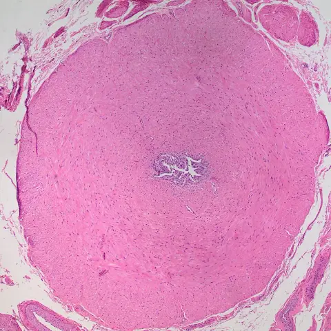 Micrograph of a round cross-section of the vas deferens with a thick pink muscular wall and a small star-shaped lumen in the centre.